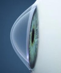 Clínica Oftalmològica Sant Boi De Llobregat