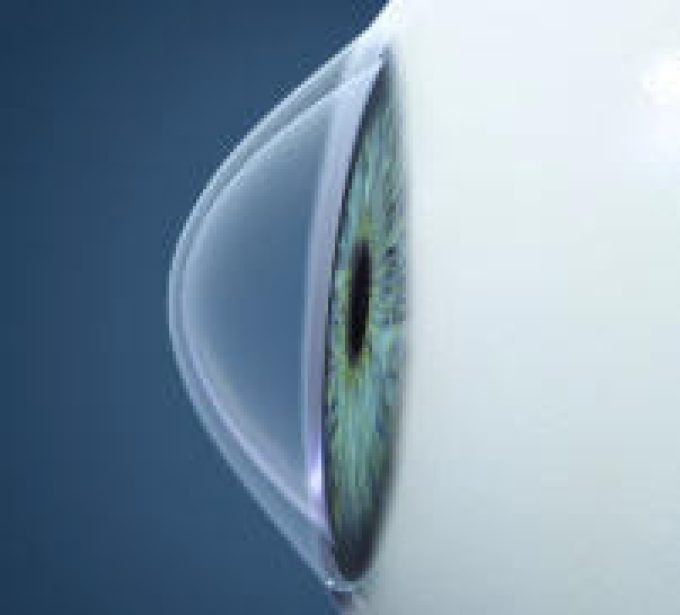 Clínica Oftalmològica Sant Boi De Llobregat