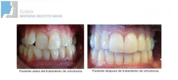 guia33-cornella-clinica-dental-clinica-dental-dra-mariana-sacoto-cornella-15934.jpg