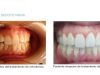 guia33-cornella-clinica-dental-clinica-dental-dra-mariana-sacoto-cornella-15935.jpg