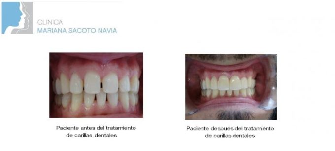 guia33-cornella-clinica-dental-clinica-dental-dra-mariana-sacoto-cornella-15936.jpg